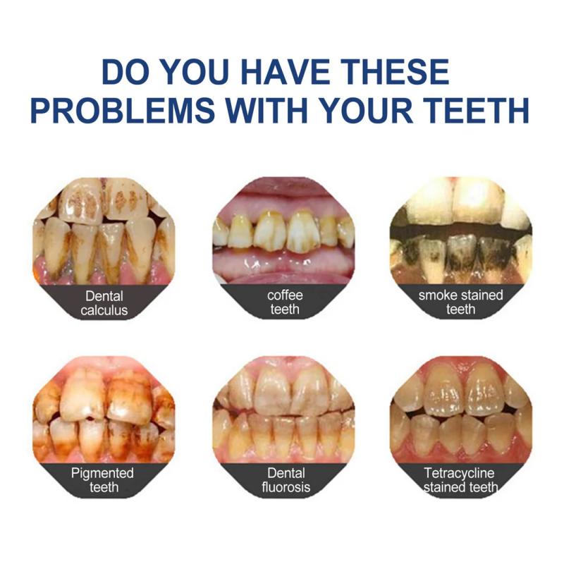 🔥Ends Tonight: Get 60% OFF Before It’s Gone!🎁 BBOJI™ Fluoride-Free Hydroxyapatite Toothpaste – Gentle Whitening &amp; Enamel Strength for Sensitive Teeth